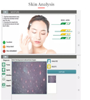 φορητός cOem συσκευών ανάλυσης φροντίδας δέρματος υγρασίας δερμάτων ανάλυσης καμερών 200X HD