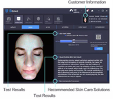 AI ευφυής συσκευή ανάλυσης 160G φροντίδας δέρματος εικόνας 1024*1280 φορητή